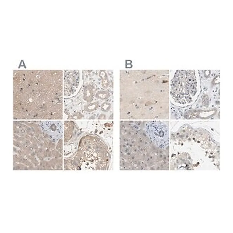 Merck Anti-DCAF7 antibody produced in rabbit