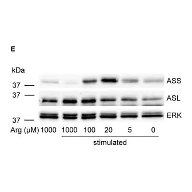 Merck Anti-ASL antibody produced in rabbit