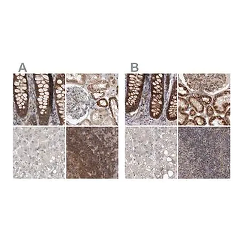 Merck Anti-DARS2 antibody produced in rabbit