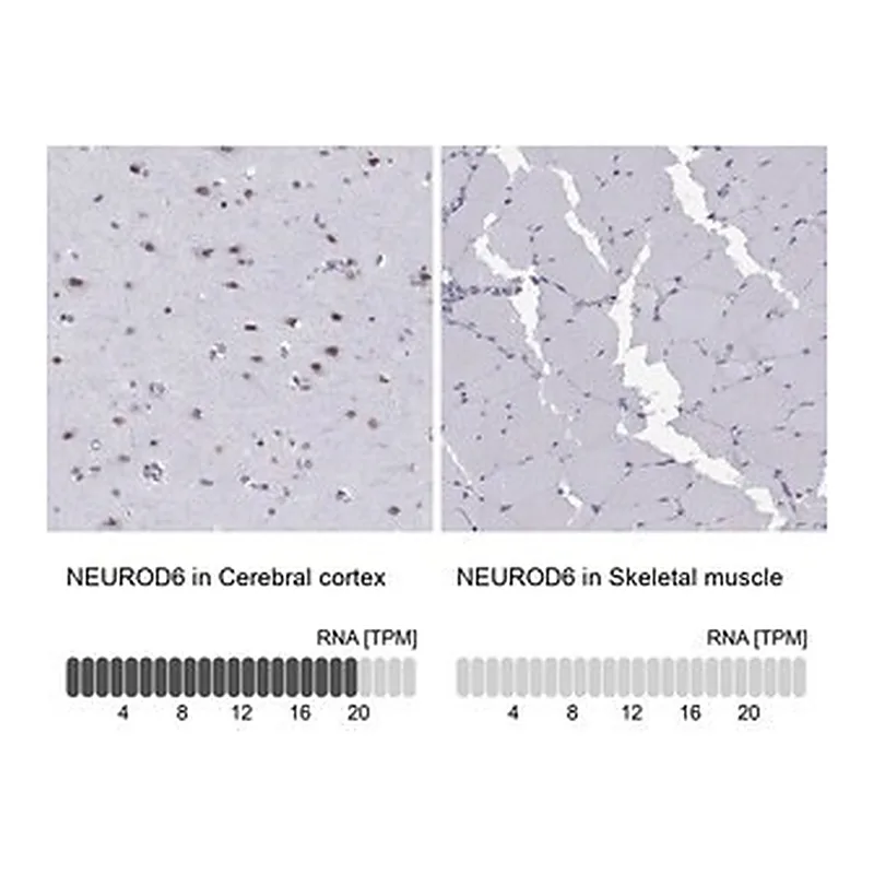 Merck Anti-NEUROD6