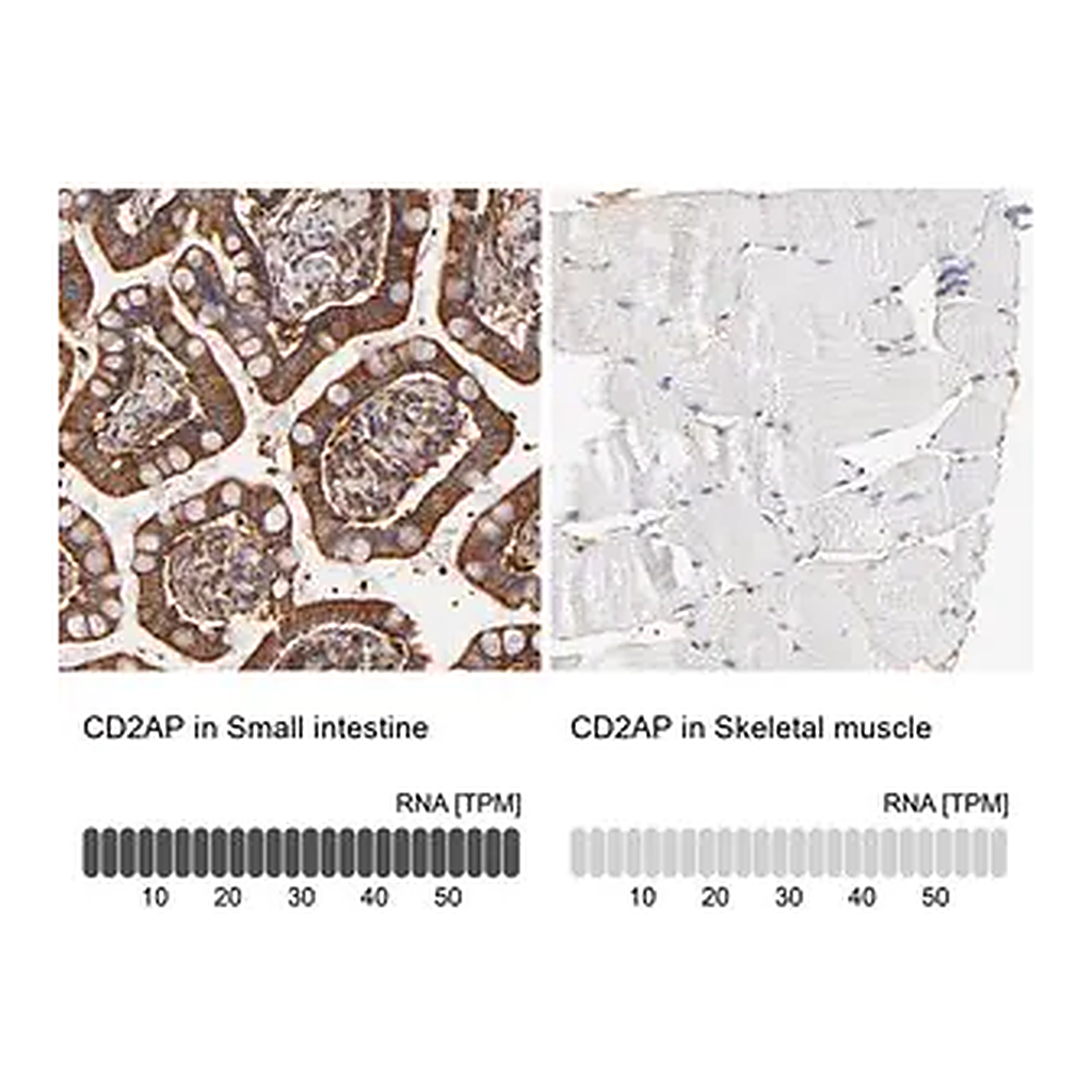 Merck Anti-CD2AP antibody produced in rabbit