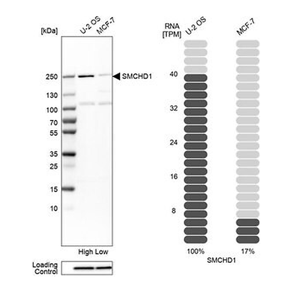 Merck Anti-SMCHD1 antibody produced in rabbit