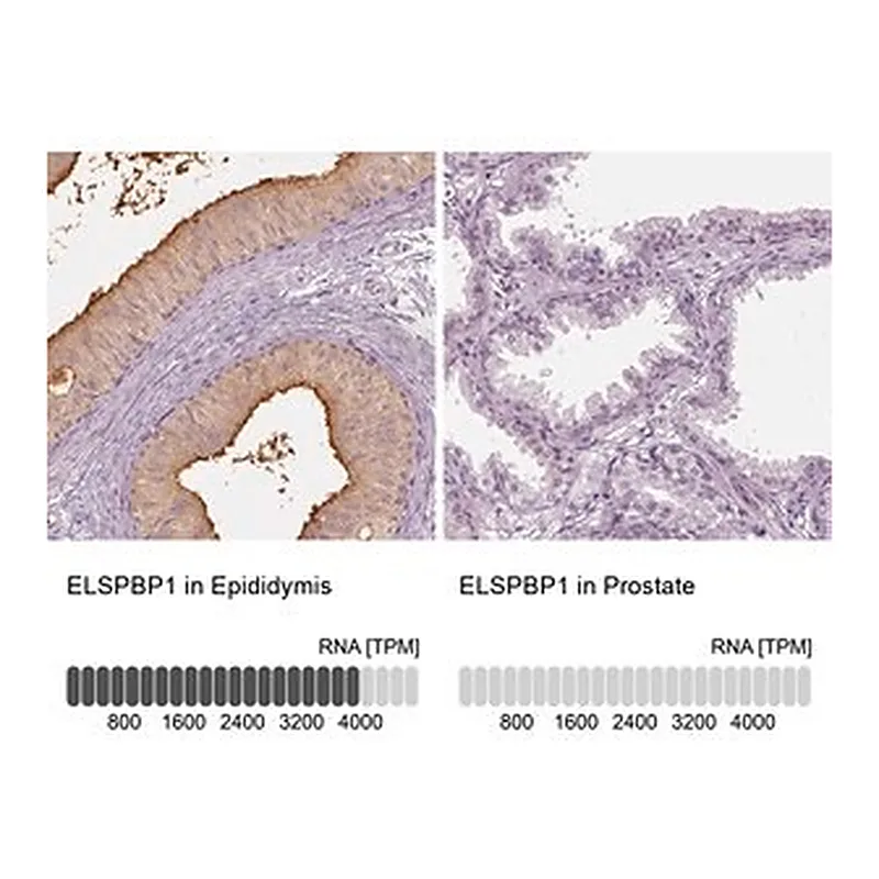 Merck Anti-ELSPBP1 antibody produced in rabbit
