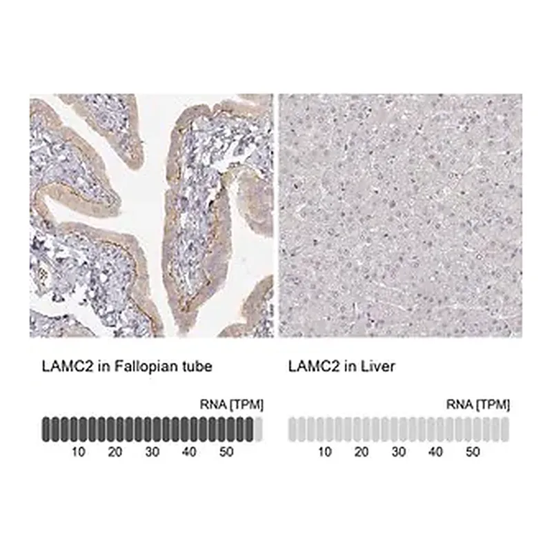 Merck Monoclonal Anti-LAMC2 antibody produced in mouse