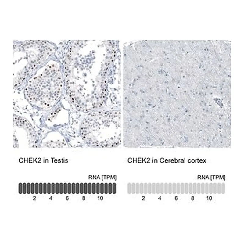 Merck Monoclonal Anti-CHEK2 antibody produced in mouse