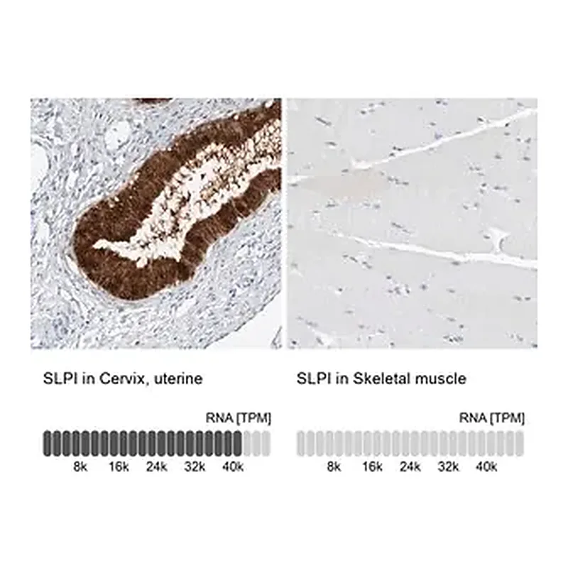 Merck Anti-SLPI antibody produced in rabbit