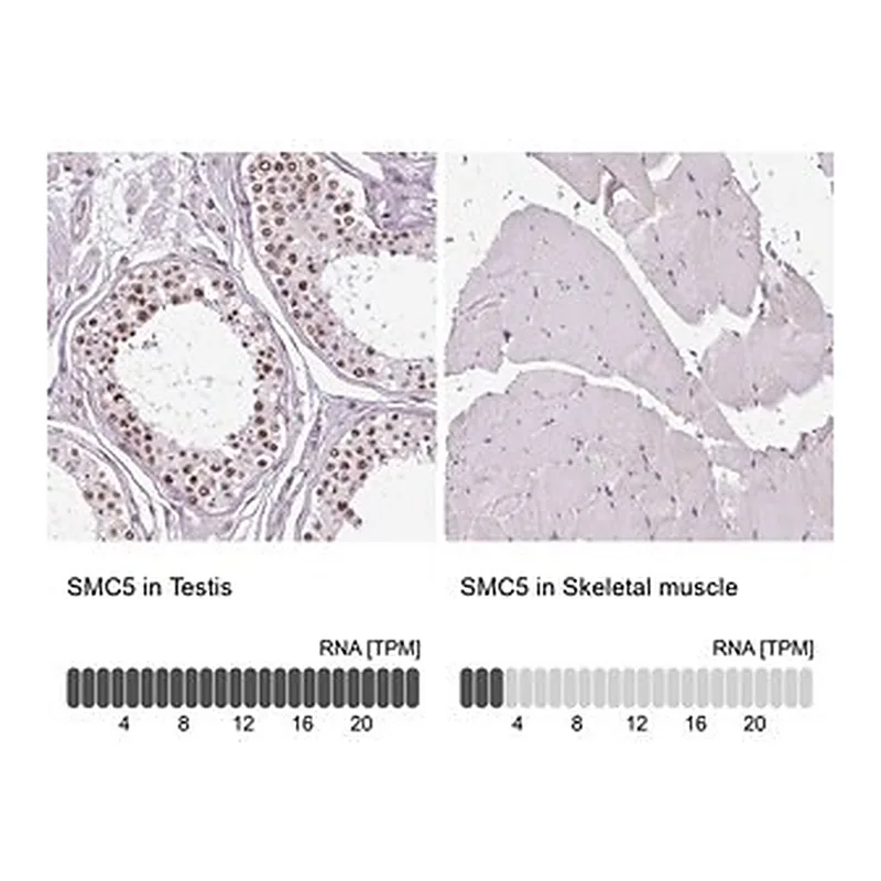 Merck Anti-SMC5 antibody produced in rabbit
