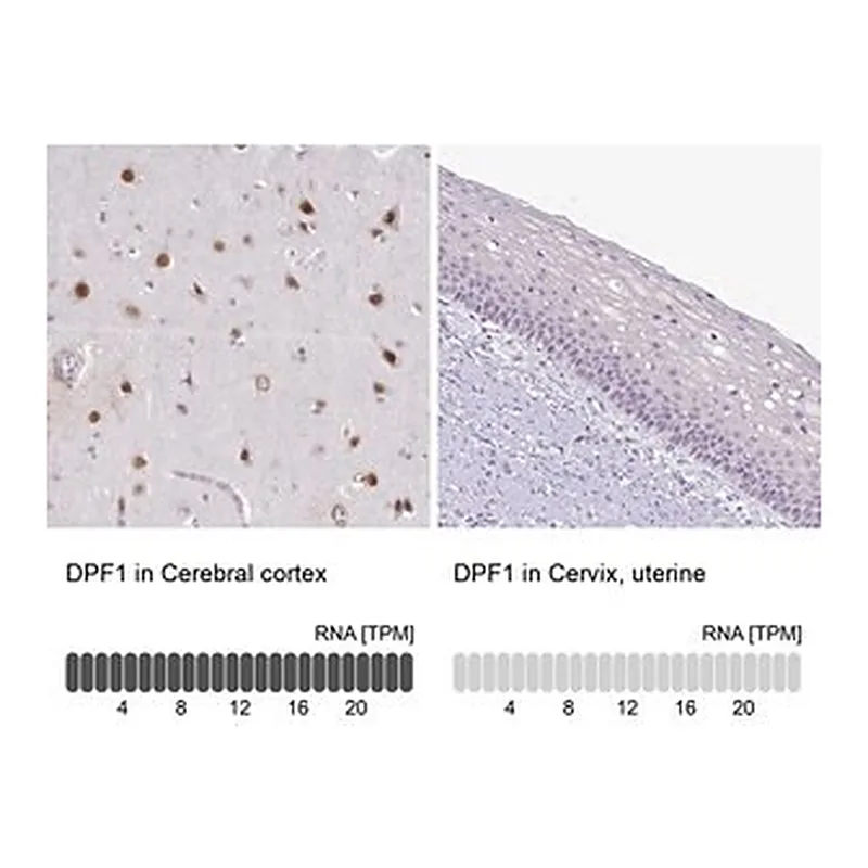 Merck Anti-DPF1 antibody produced in rabbit