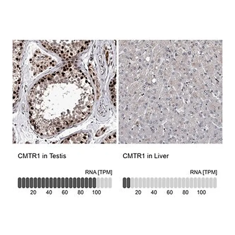 Merck Anti-CMTR1 antibody produced in rabbit