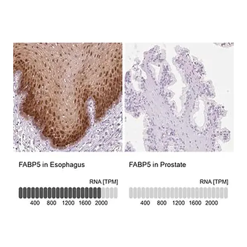 Merck Anti-FABP5 antibody produced in rabbit