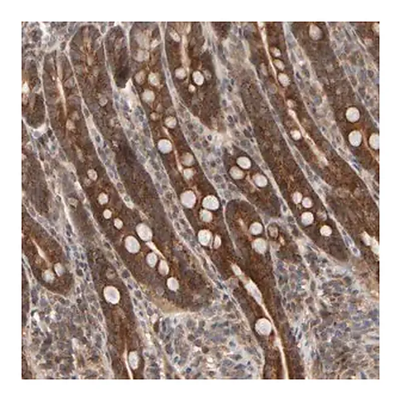 Merck Anti-ABHD11 antibody produced in rabbit
