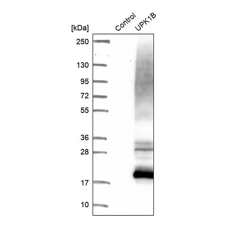 Merck Anti-UPK1B antibody produced in rabbit
