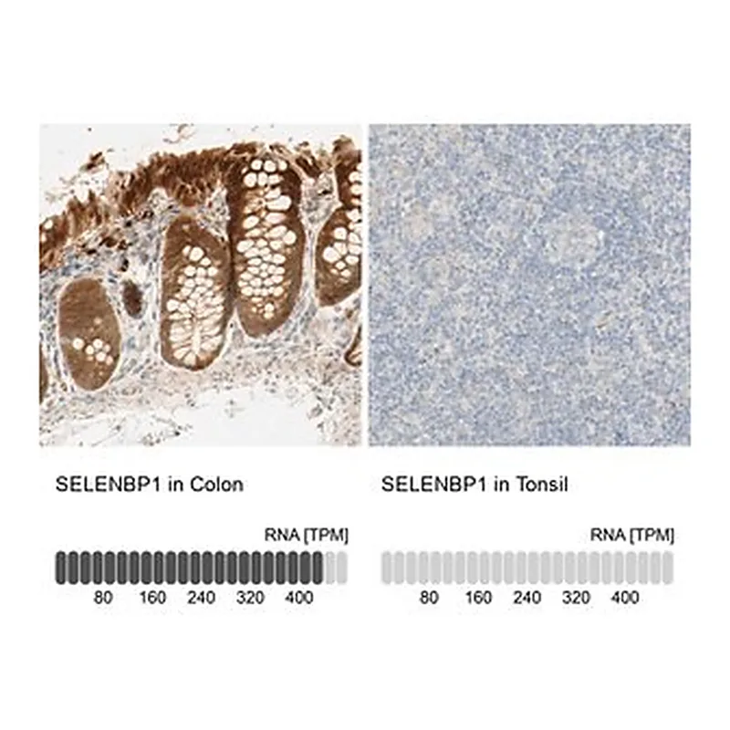 Merck Anti-SELENBP1 antibody produced in rabbit