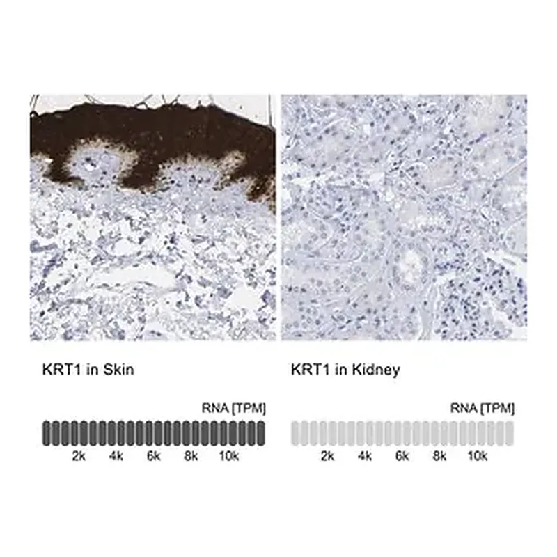 Merck Anti-KRT1 antibody produced in rabbit