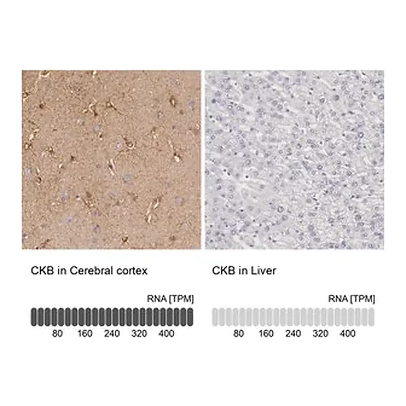 Merck Anti-CKB antibody produced in rabbit
