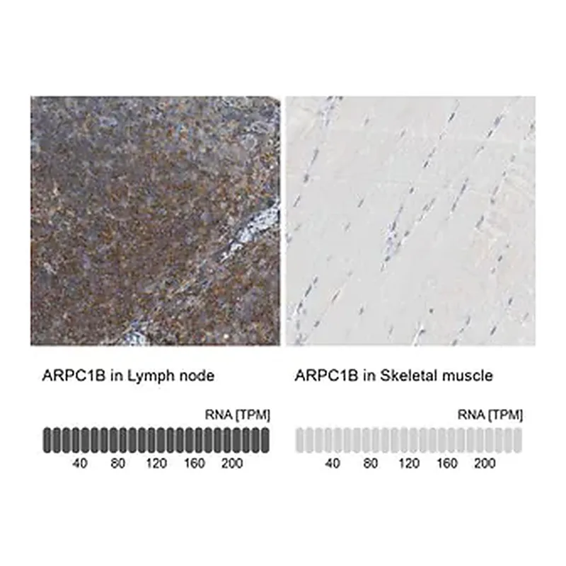 Merck Anti-ARPC1B antibody produced in rabbit