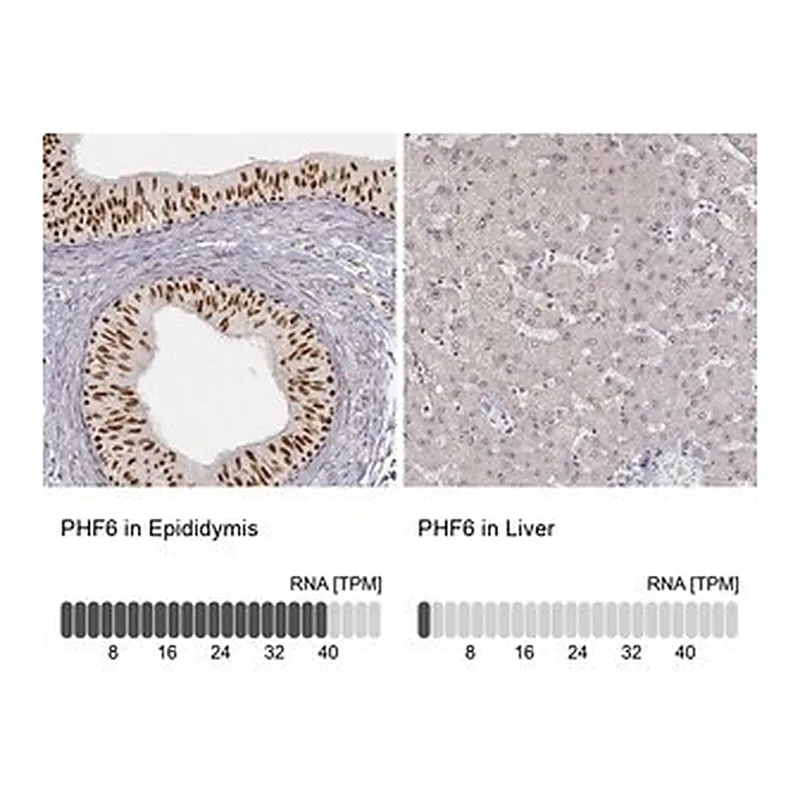 Merck Anti-PHF6 antibody produced in rabbit