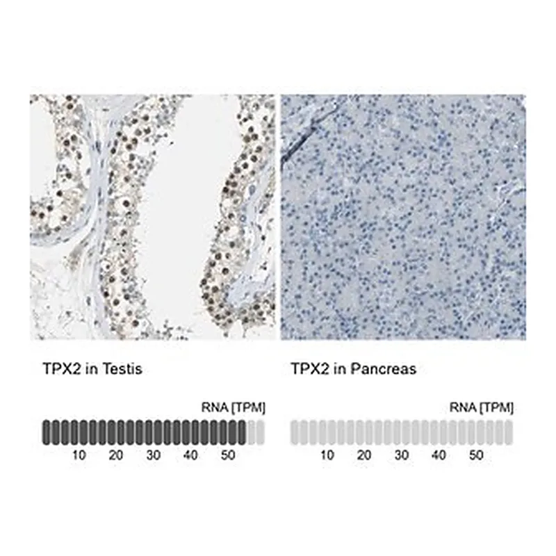 Merck Anti-TPX2 antibody produced in rabbit