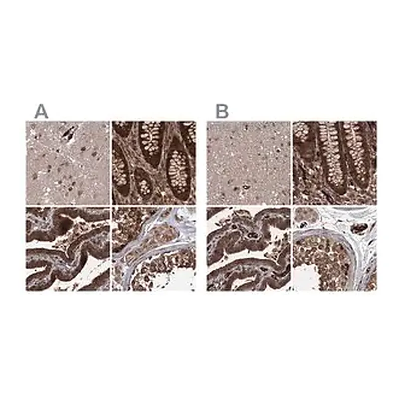 Merck Anti-RPAP3 antibody produced in rabbit