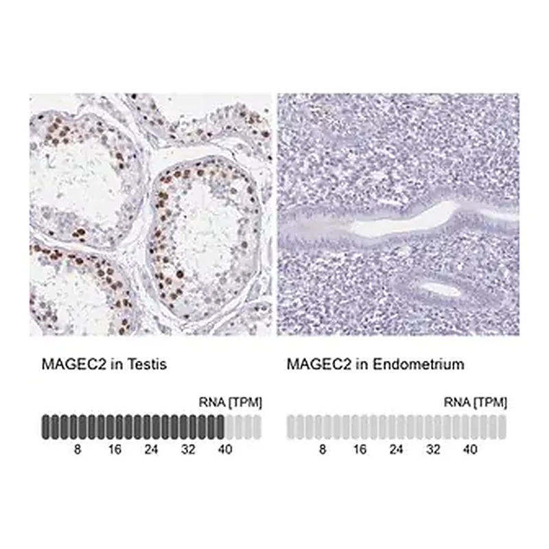 Merck Anti-MAGEC2 antibody produced in rabbit