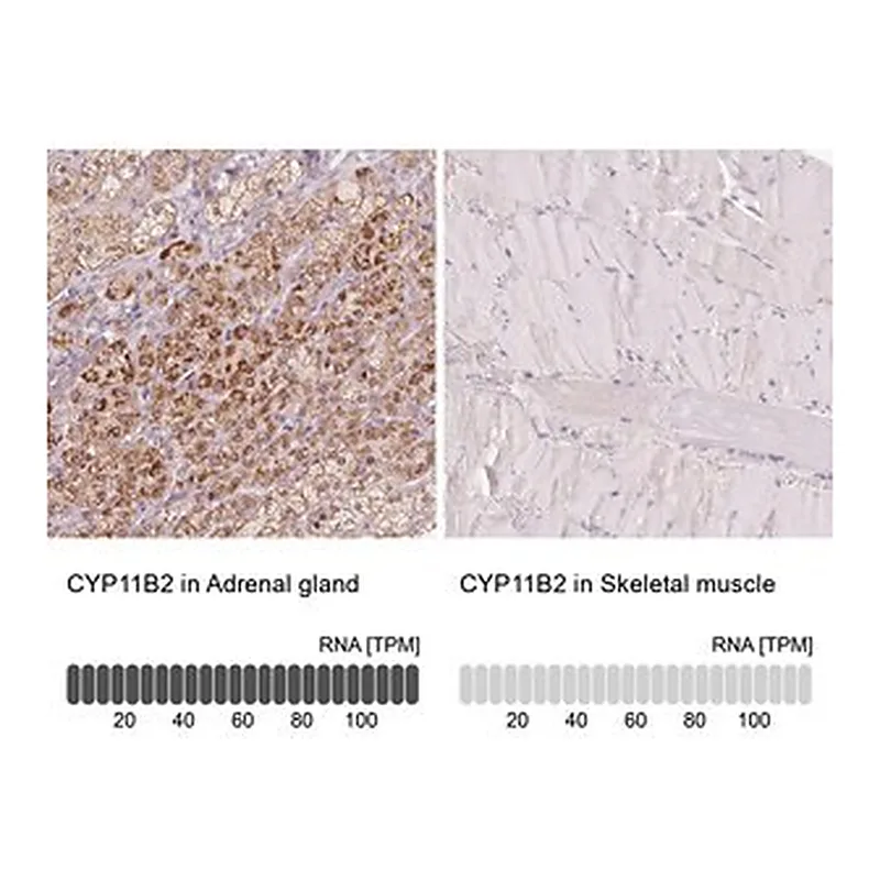 Merck Anti-CYP11B2 antibody produced in rabbit