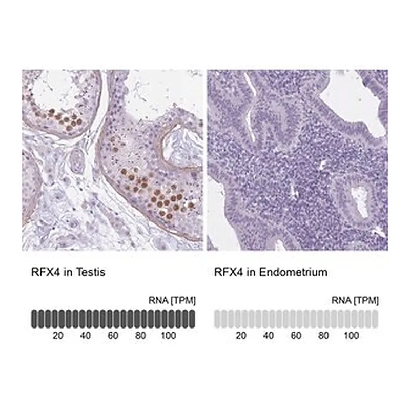 Merck Anti-RFX4 antibody produced in rabbit