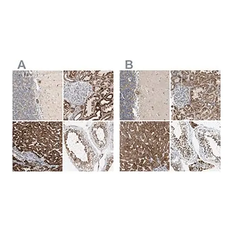 Merck Anti-ACAT1 antibody produced in rabbit