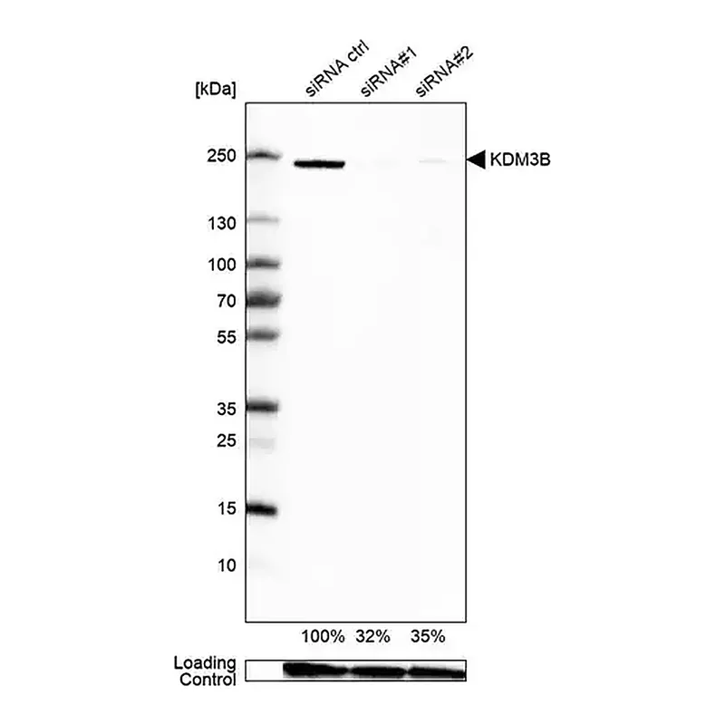 Merck Anti-KDM3B antibody produced in rabbit