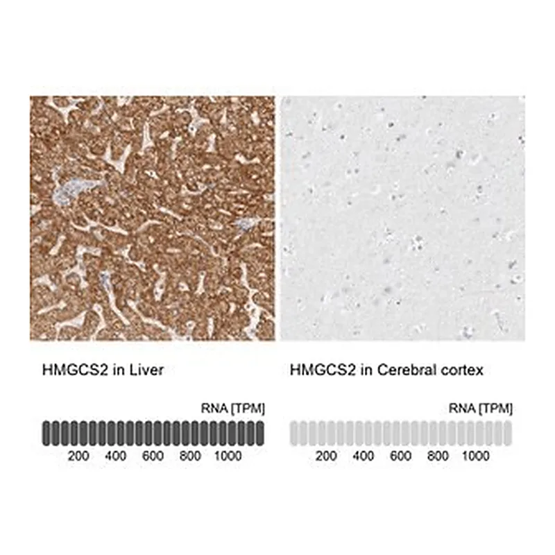 Merck Anti-HMGCS2 antibody produced in rabbit