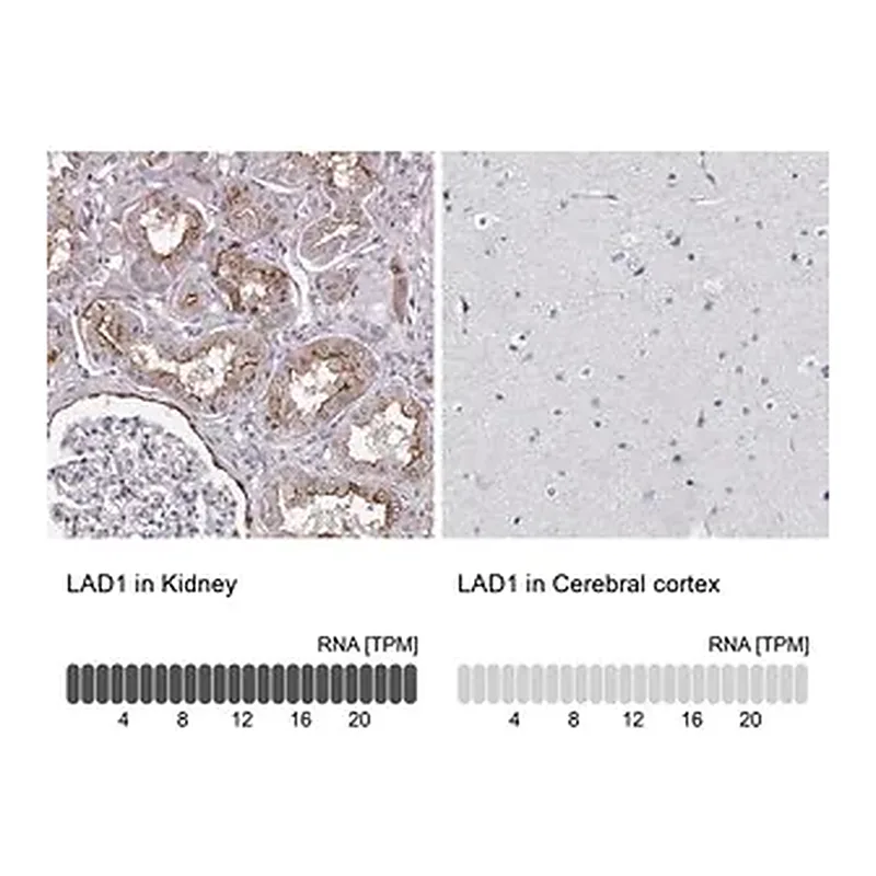 Merck Anti-LAD1 antibody produced in rabbit
