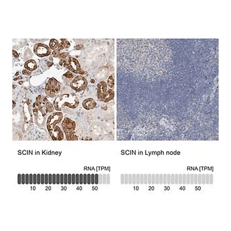 Merck Anti-SCIN antibody produced in rabbit