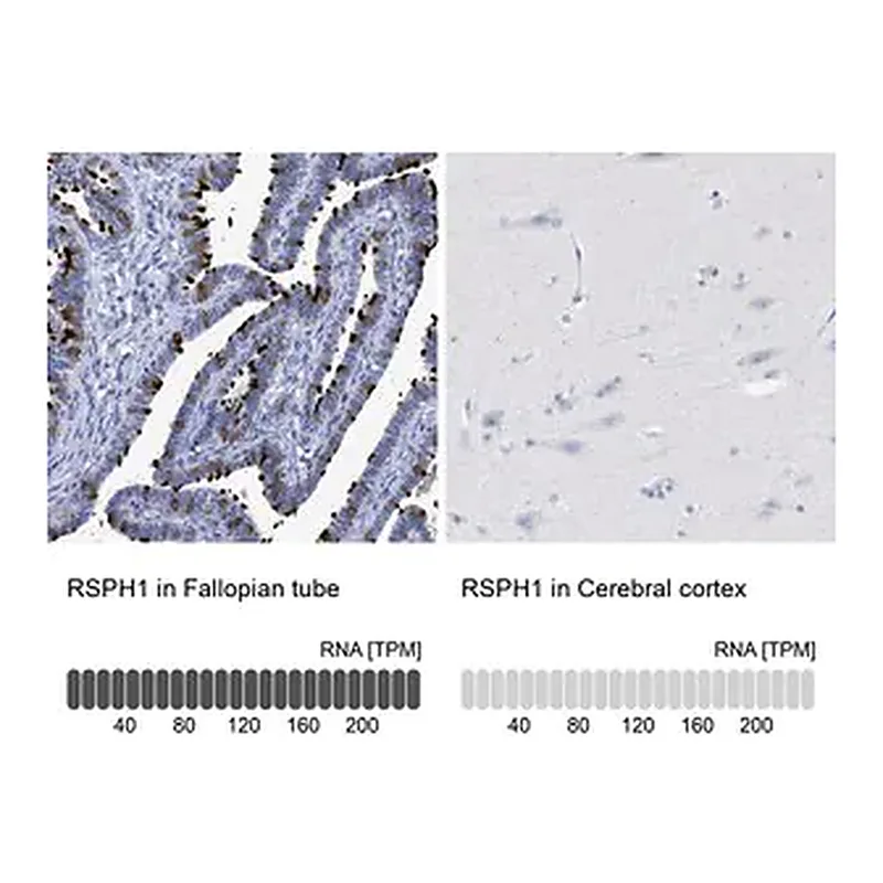 Merck Anti-RSPH1 antibody produced in rabbit