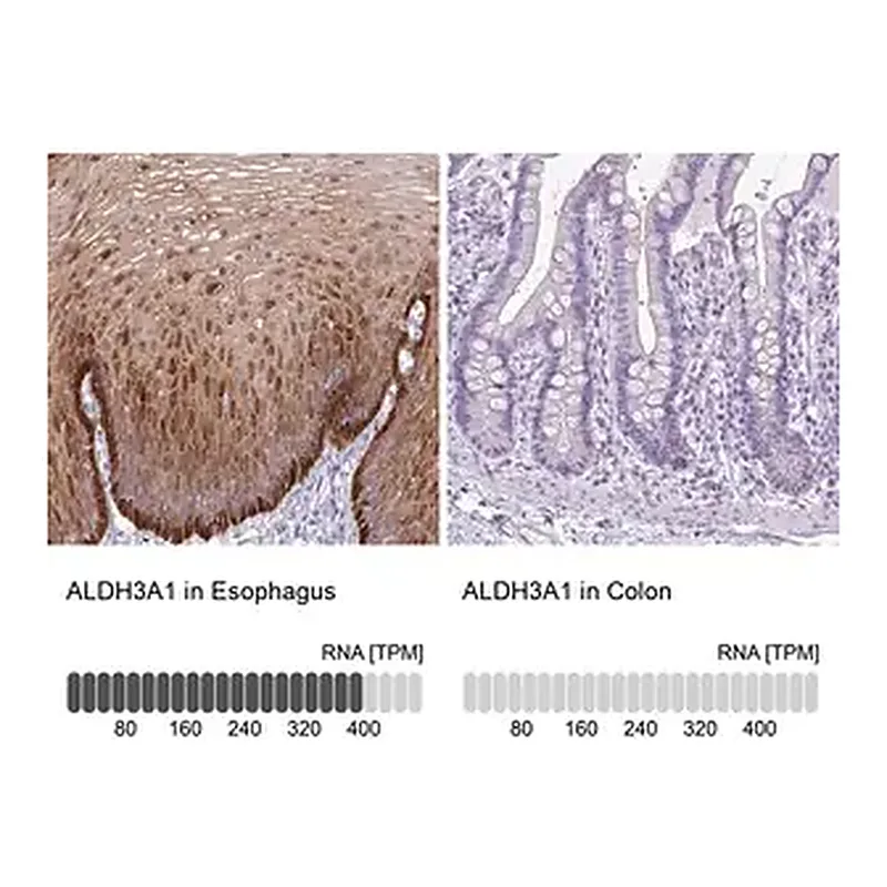 Merck Anti-ALDH3A1 antibody produced in rabbit