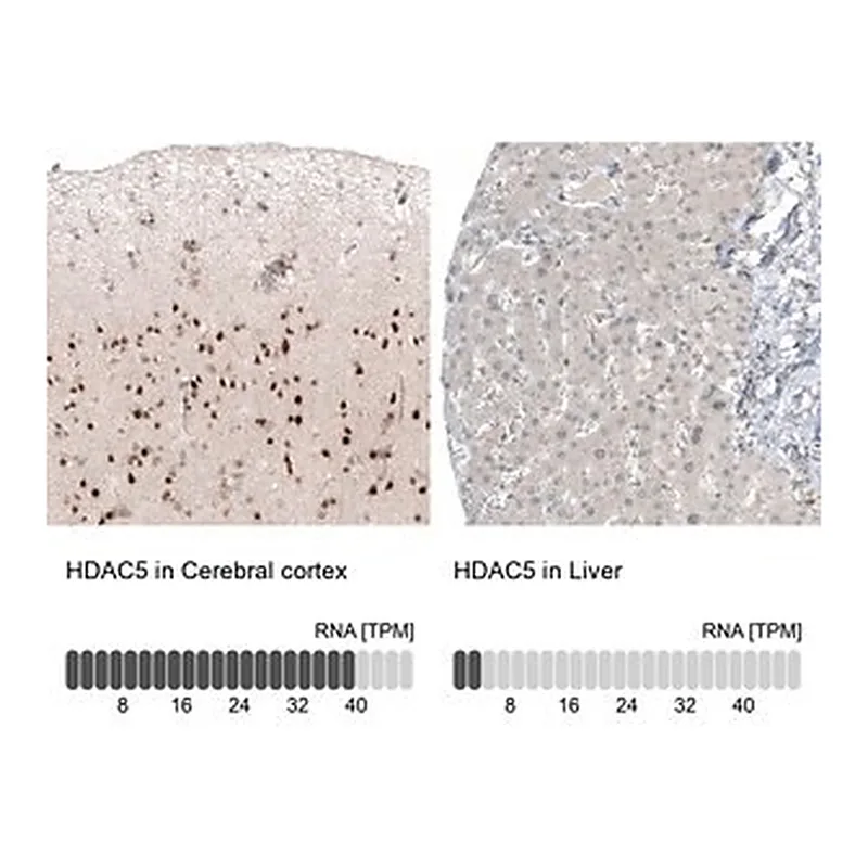 Merck Monoclonal Anti-HDAC5 antibody produced in mouse