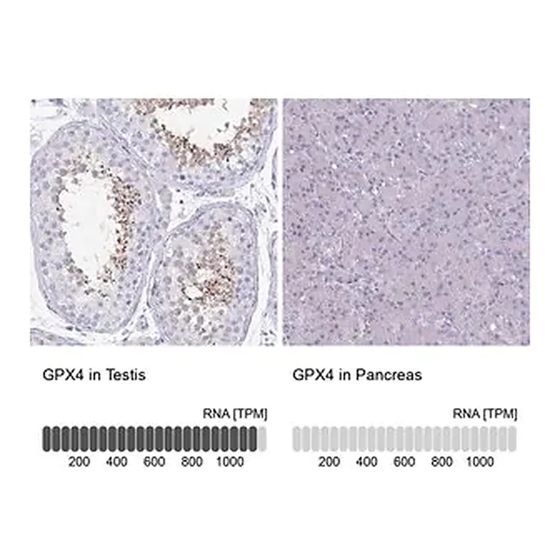 Merck Anti-GPX4 antibody produced in rabbit