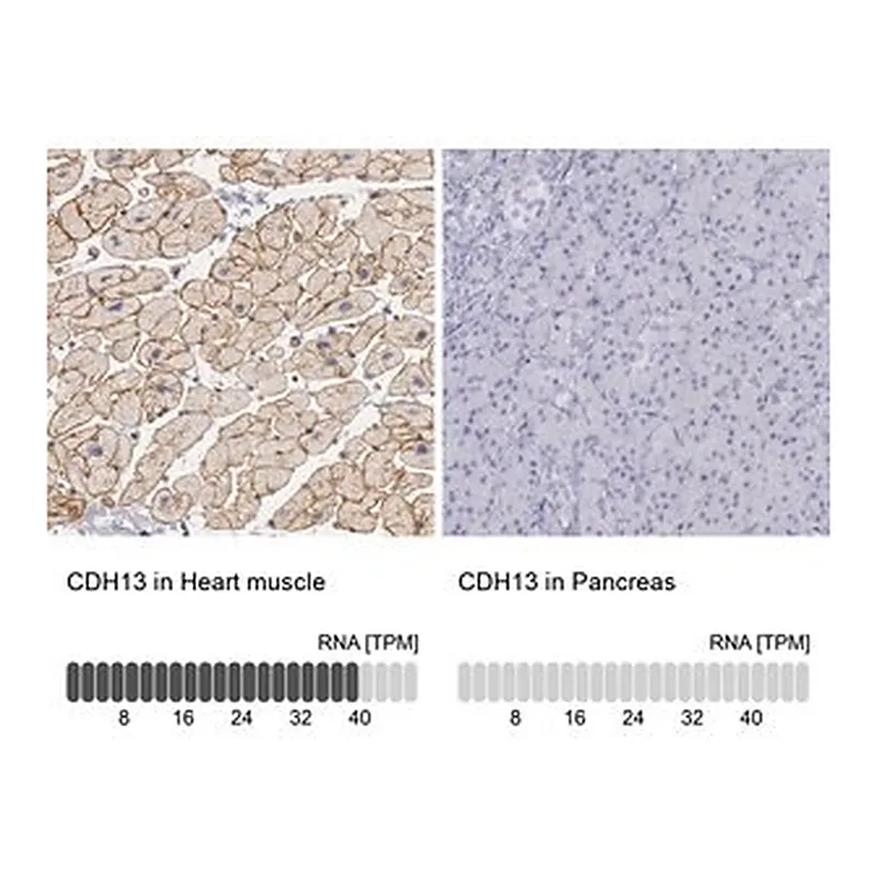 Merck Anti-CDH13 antibody produced in rabbit
