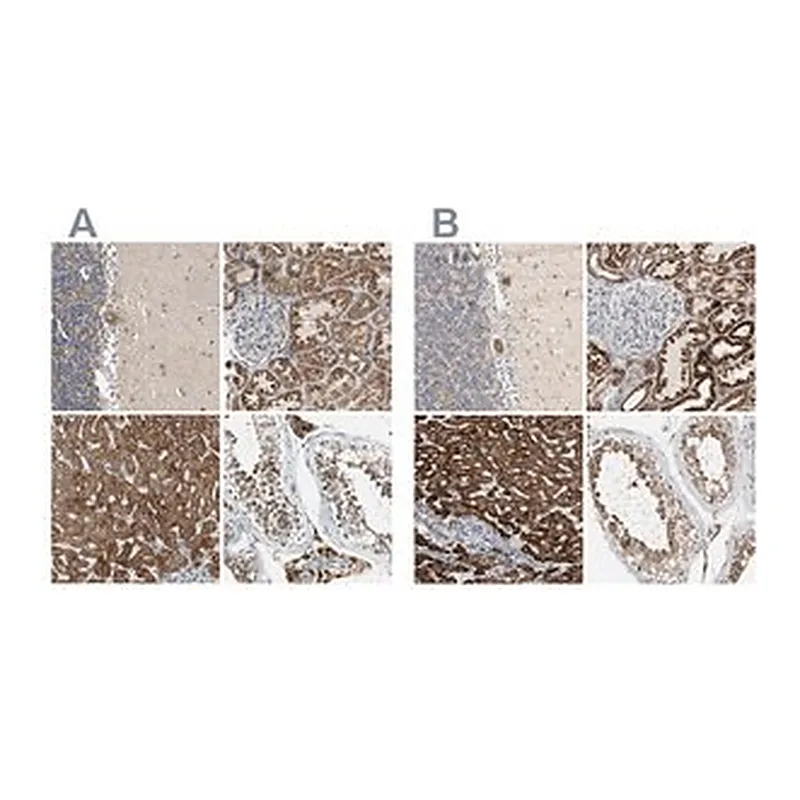 Merck Anti-ACAT1 antibody produced in rabbit