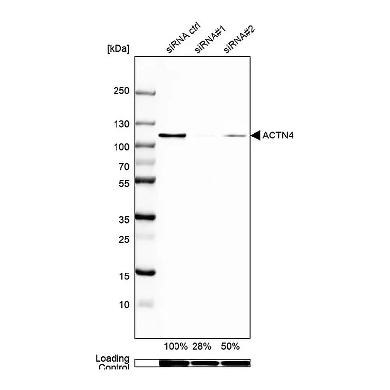 Merck Anti-ACTN4 antibody produced in rabbit