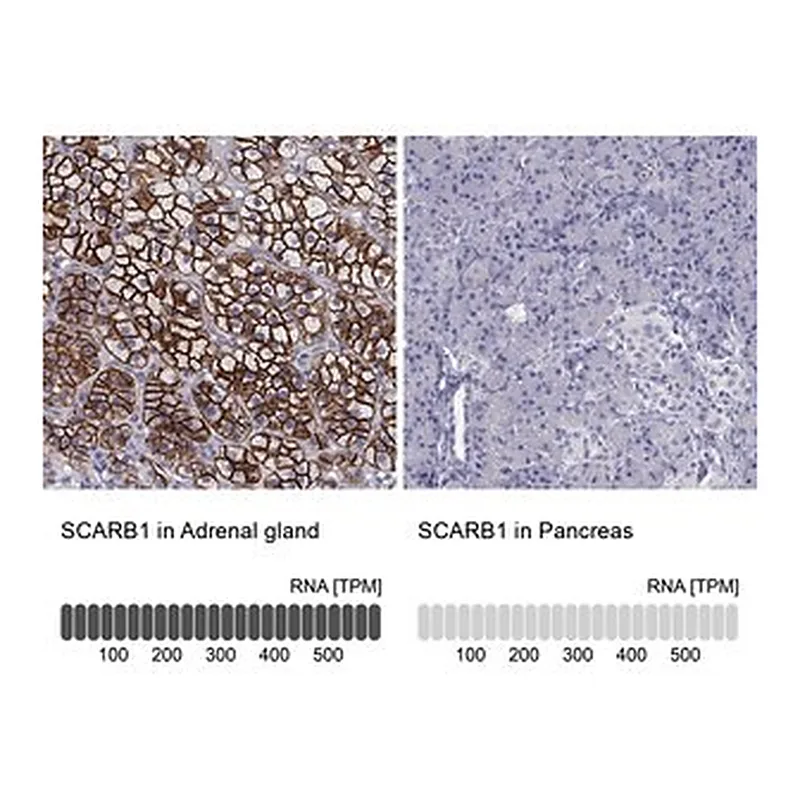 Merck Anti-SCARB1