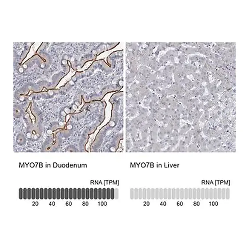 Merck Anti-MYO7B antibody produced in rabbit