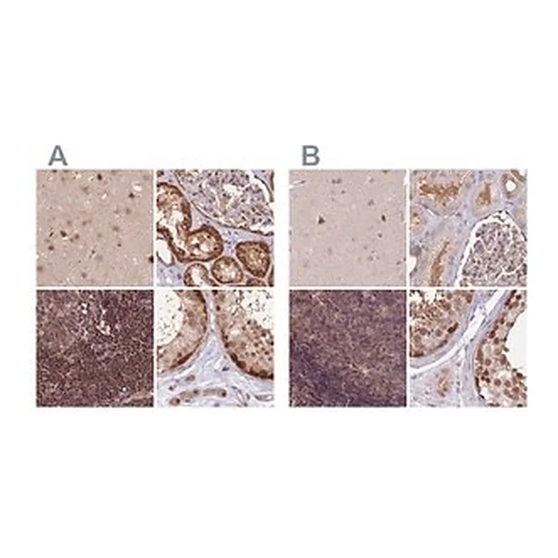 Merck Anti-NSFL1C antibody produced in rabbit