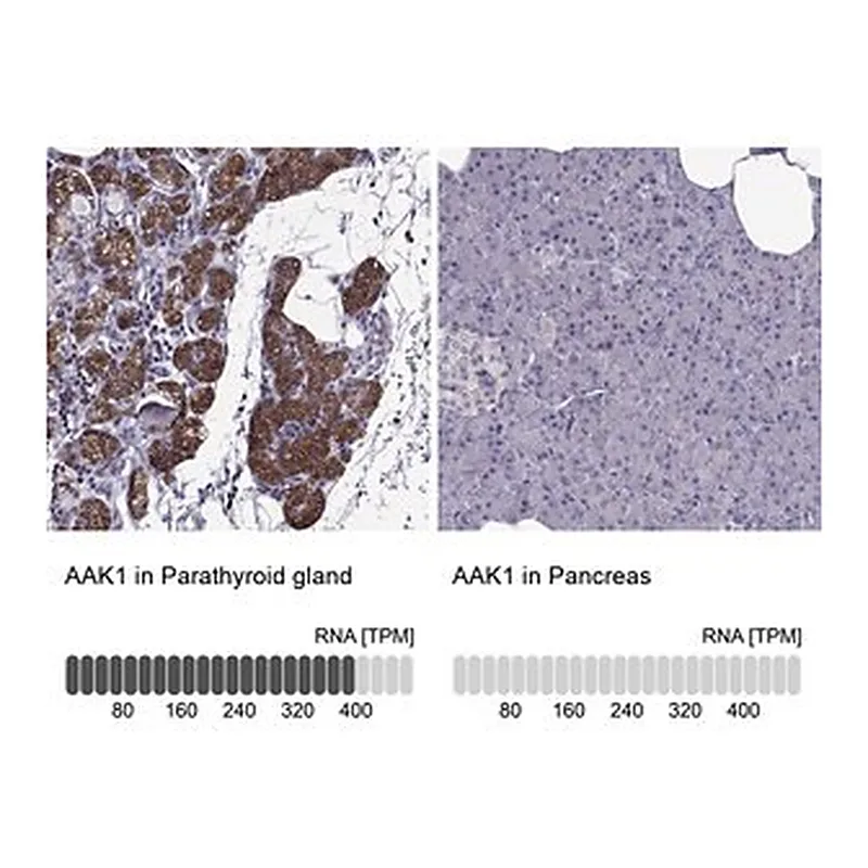 Merck Anti-AAK1 antibody produced in rabbit