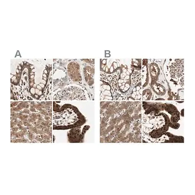 Merck Anti-GALT antibody produced in rabbit