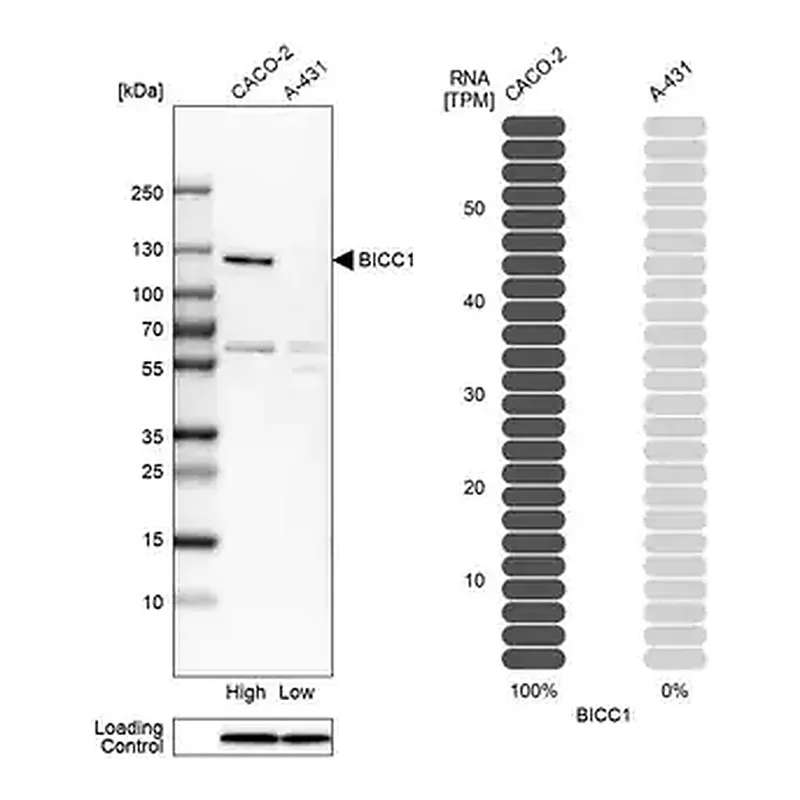 Merck Anti-BICC1 antibody produced in rabbit