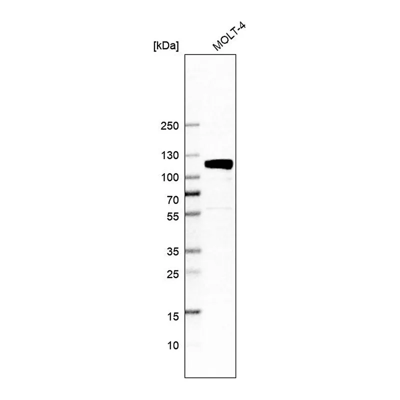 Merck Anti-QRICH1 antibody produced in rabbit