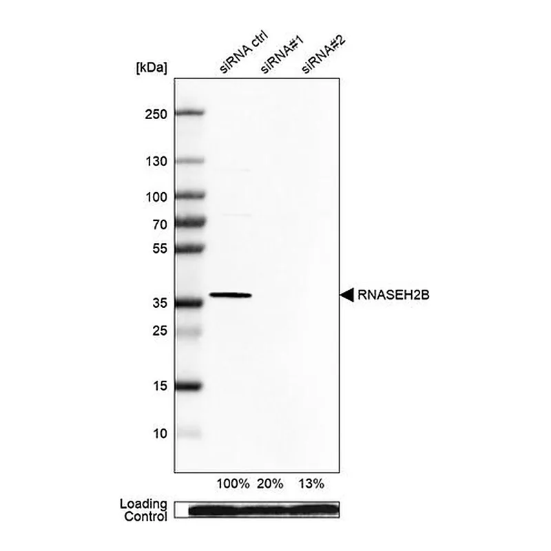 Merck Anti-RNASEH2B antibody produced in rabbit