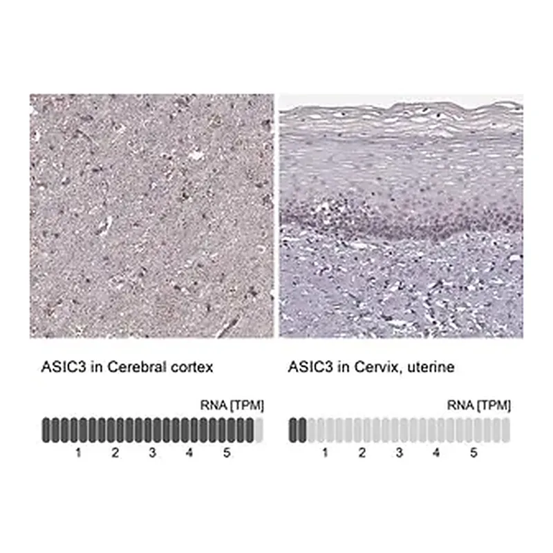 Merck Anti-ASIC3