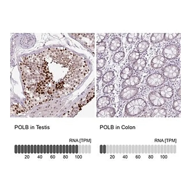 Merck Anti-POLB antibody produced in rabbit