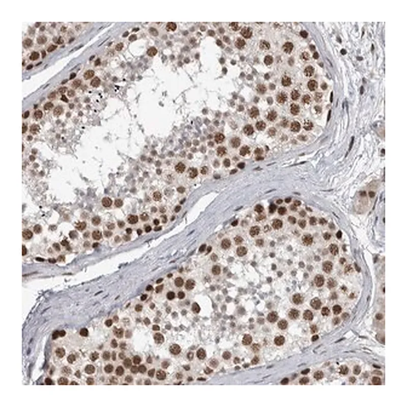 Merck Anti-DDX42 antibody produced in rabbit