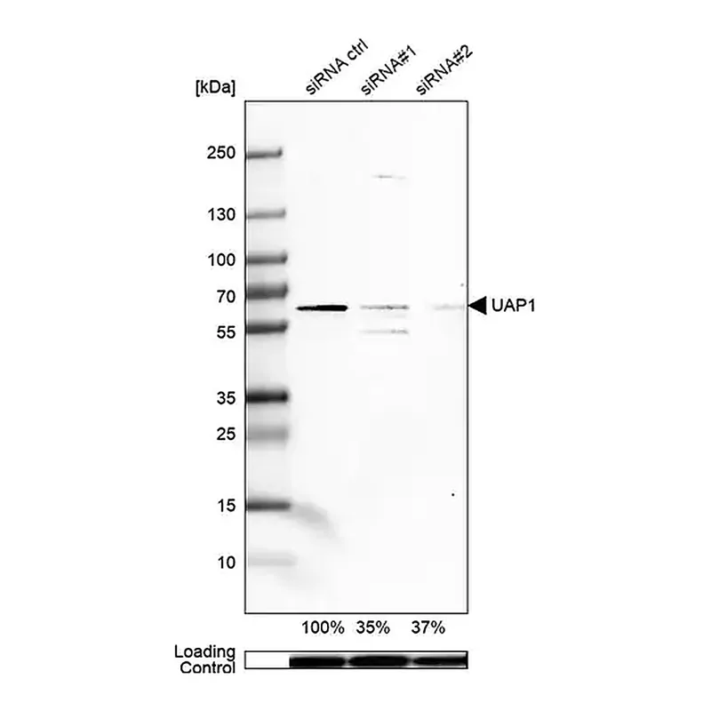Merck Anti-UAP1 antibody produced in rabbit